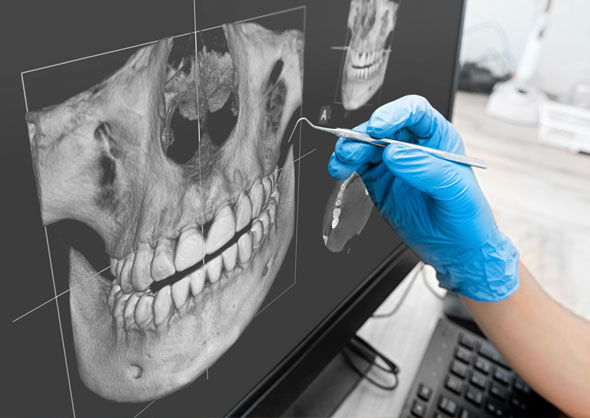 3D CBCT x-ray