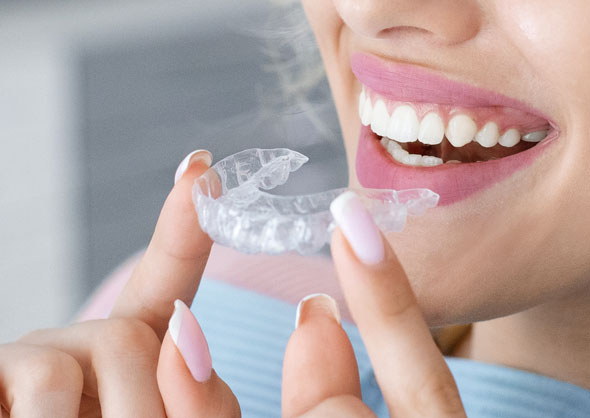 Woman inserting clear aligner